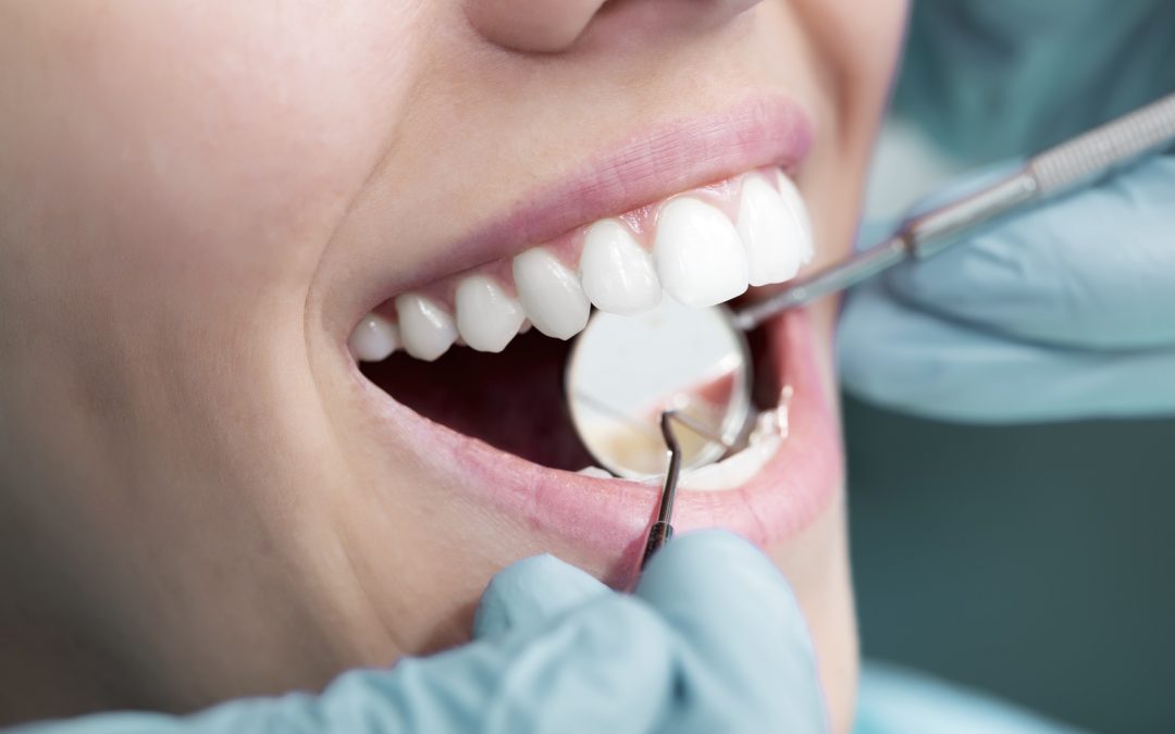 5 Common Dental Hygiene Mistakes That You Should Definitely Avoid